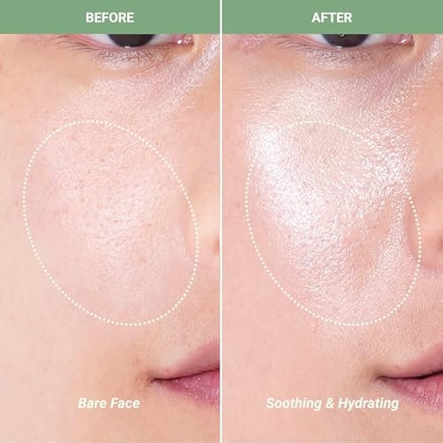 Meebak CICA Toner Spray | Korean Face Mist | Facial Spray with Centella Asiatica & Vitamin E | Soothing Face Toner for Sensitive, Oily, and Combination Skin | 4 fl oz