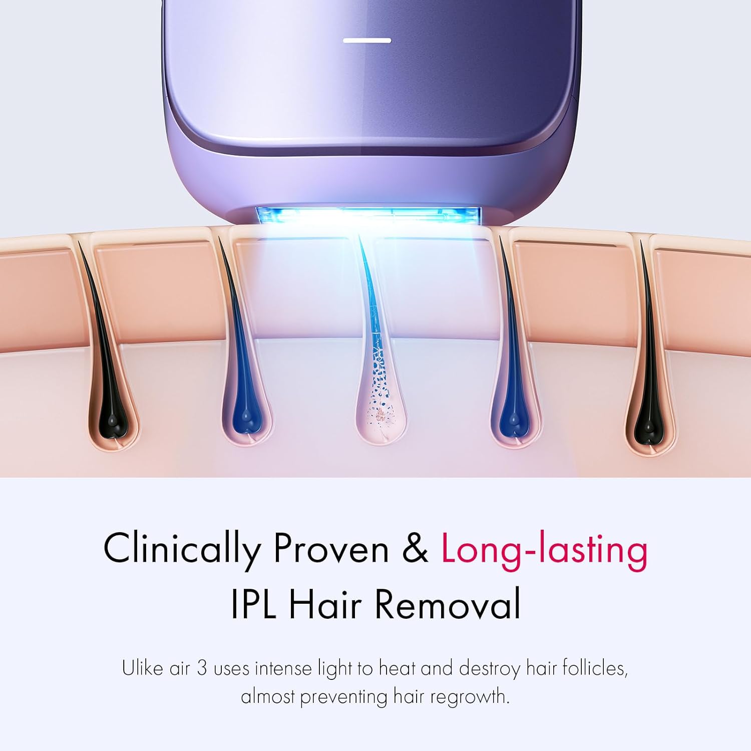 Ulike Hair Removal for Women and Men, Air 3 Ice-Cooling IPL Hair Removal Device for Nearly Painless & Long-Lasting Results, 3 Modes & Auto Flashing for Fast Full Body Hair Removal from Home
