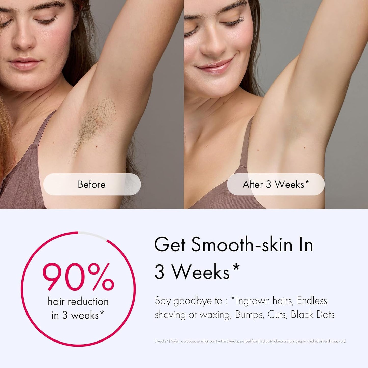 Ulike Hair Removal for Women and Men, Air 3 Ice-Cooling IPL Hair Removal Device for Nearly Painless & Long-Lasting Results, 3 Modes & Auto Flashing for Fast Full Body Hair Removal from Home
