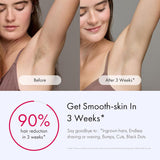 Ulike Hair Removal for Women and Men, Air 3 Ice-Cooling IPL Hair Removal Device for Nearly Painless & Long-Lasting Results, 3 Modes & Auto Flashing for Fast Full Body Hair Removal from Home