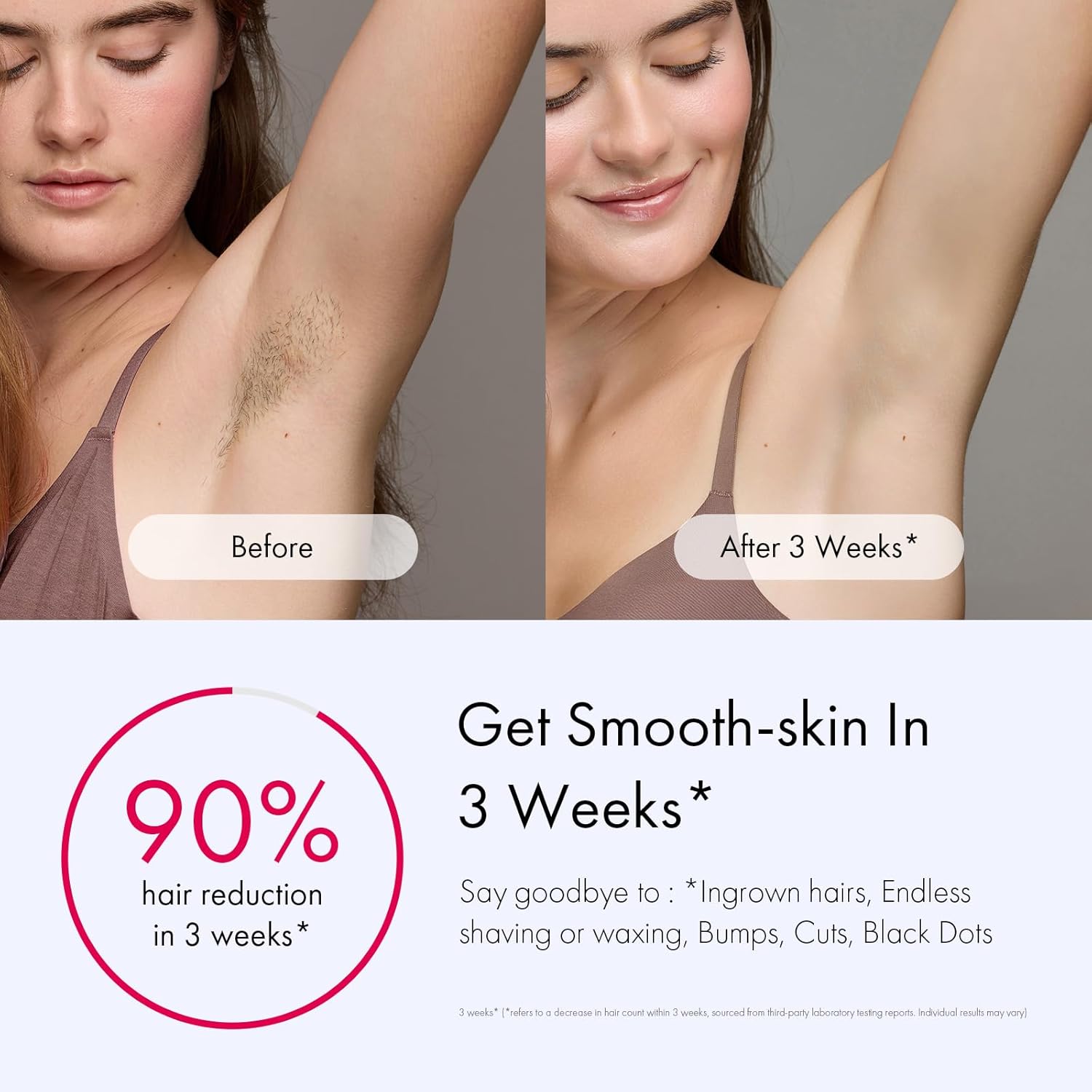 Ulike Hair Removal for Women and Men, Air 3 Ice-Cooling IPL Hair Removal Device for Nearly Painless & Long-Lasting Results, 3 Modes & Auto Flashing for Fast Full Body Hair Removal from Home