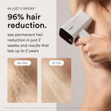 Nood™ NEW Flasher Pro — IPL Hair Removal Device & Anti-Aging Red Light Therapy for Women & Men — Pain-free, Permanent, Visible Results After First Use & Works Everywhere Hair Grows — Gloss White
