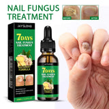 7 Days Ginger Nail Fungus Repair Essence Moisturizing Growth Strengthening With Gray Nail Treatment Natural Nails Care
